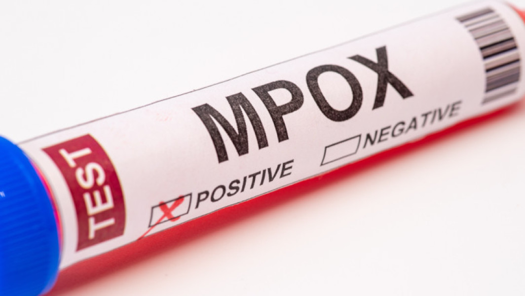 OMS declară mpox, o urgență de sănătate publică globală
