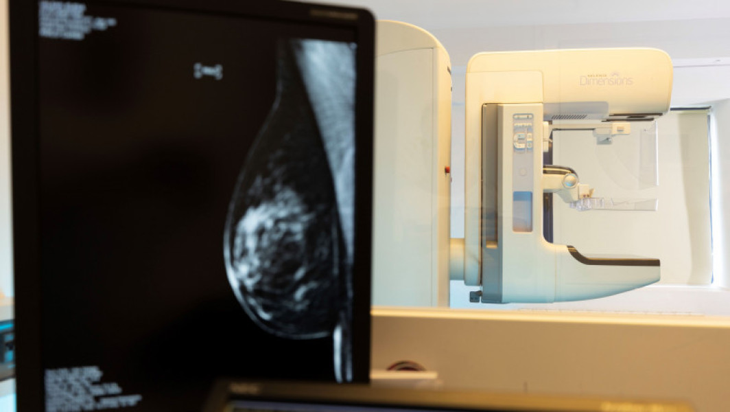 Cancerul mamar: importanța screening-ului și a diagnosticării timpurii