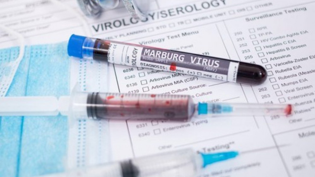 Rwanda înregistrează noi cazuri de infectare cu virusul Marburg