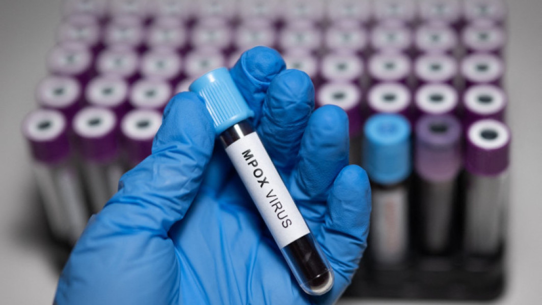 OMS aprobă primul test rapid pentru diagnosticarea mpox