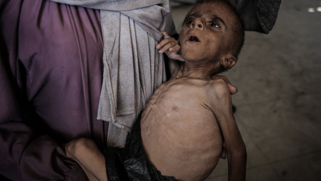 Criză de malnutriție în Gaza: peste 7.000 de copii sub cinci ani în programe de recuperare