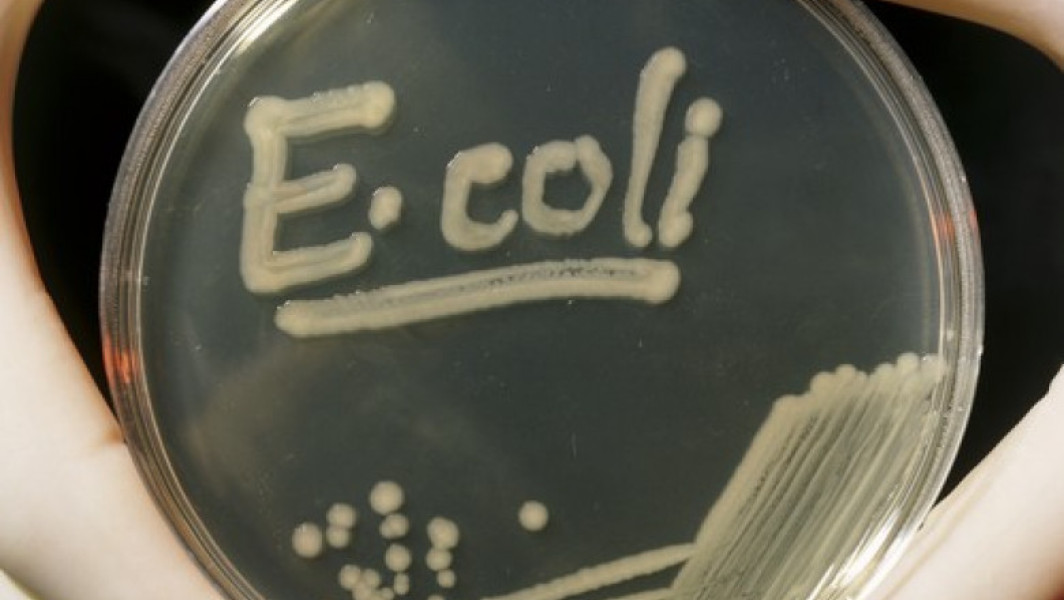 Un caz de deces în Marea Britanie asociat cu epidemia de E. coli