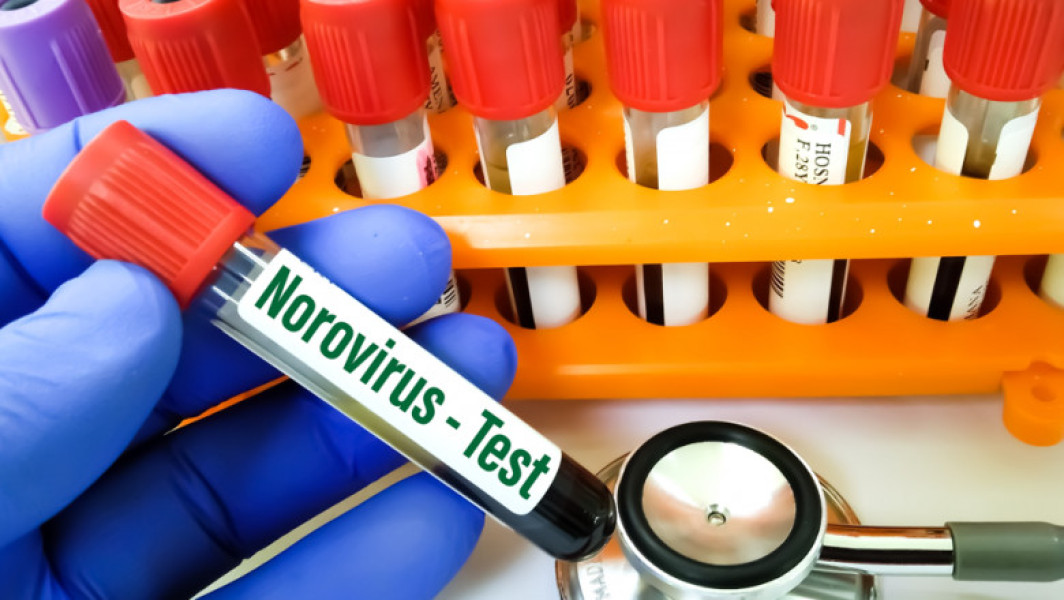 Focar de norovirus în Torri del Benaco, Italia: peste 300 de persoane spitalizate